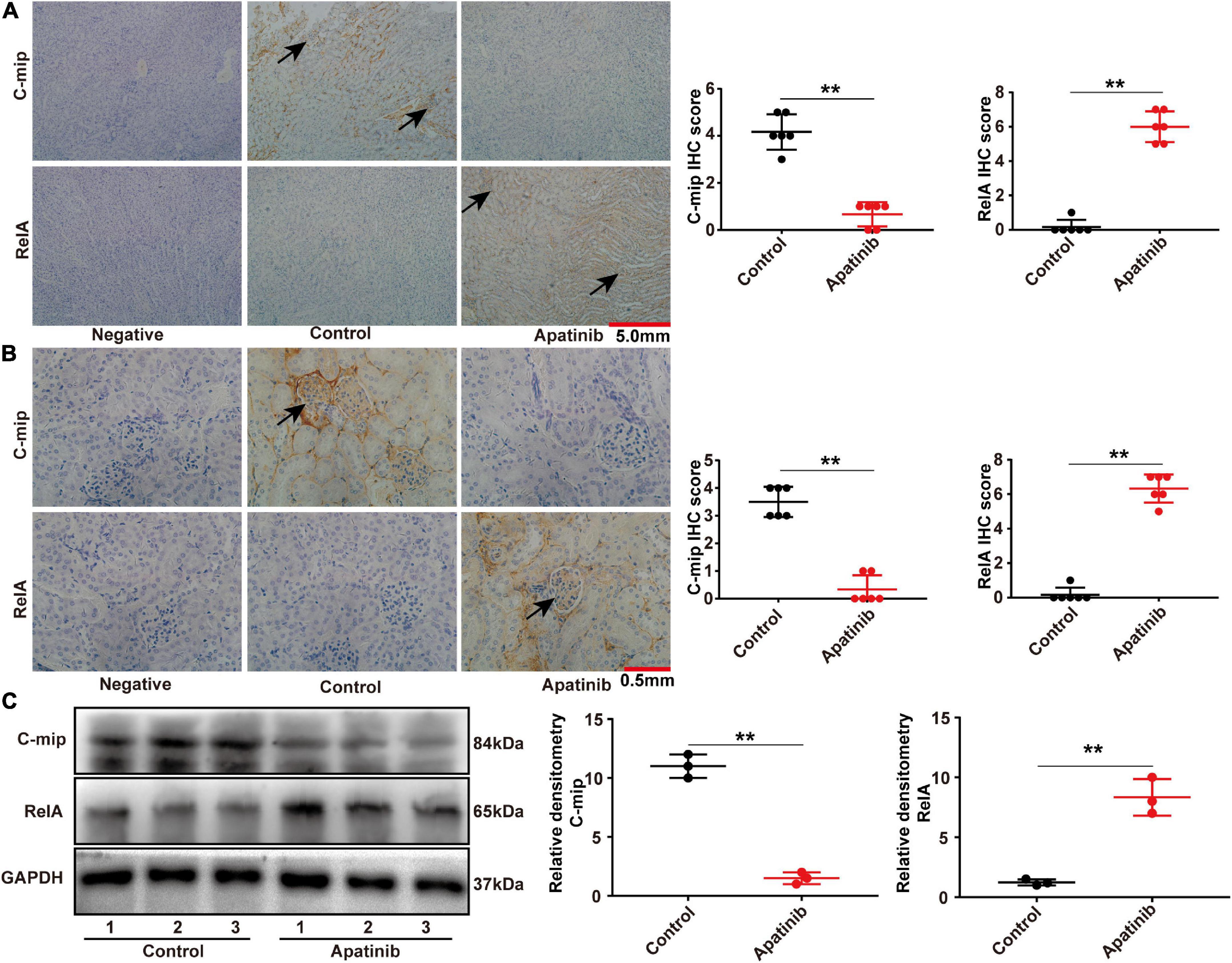 LDP alleviates TKI-induced proteinuria through reversing the expression of RelA in renal tissues